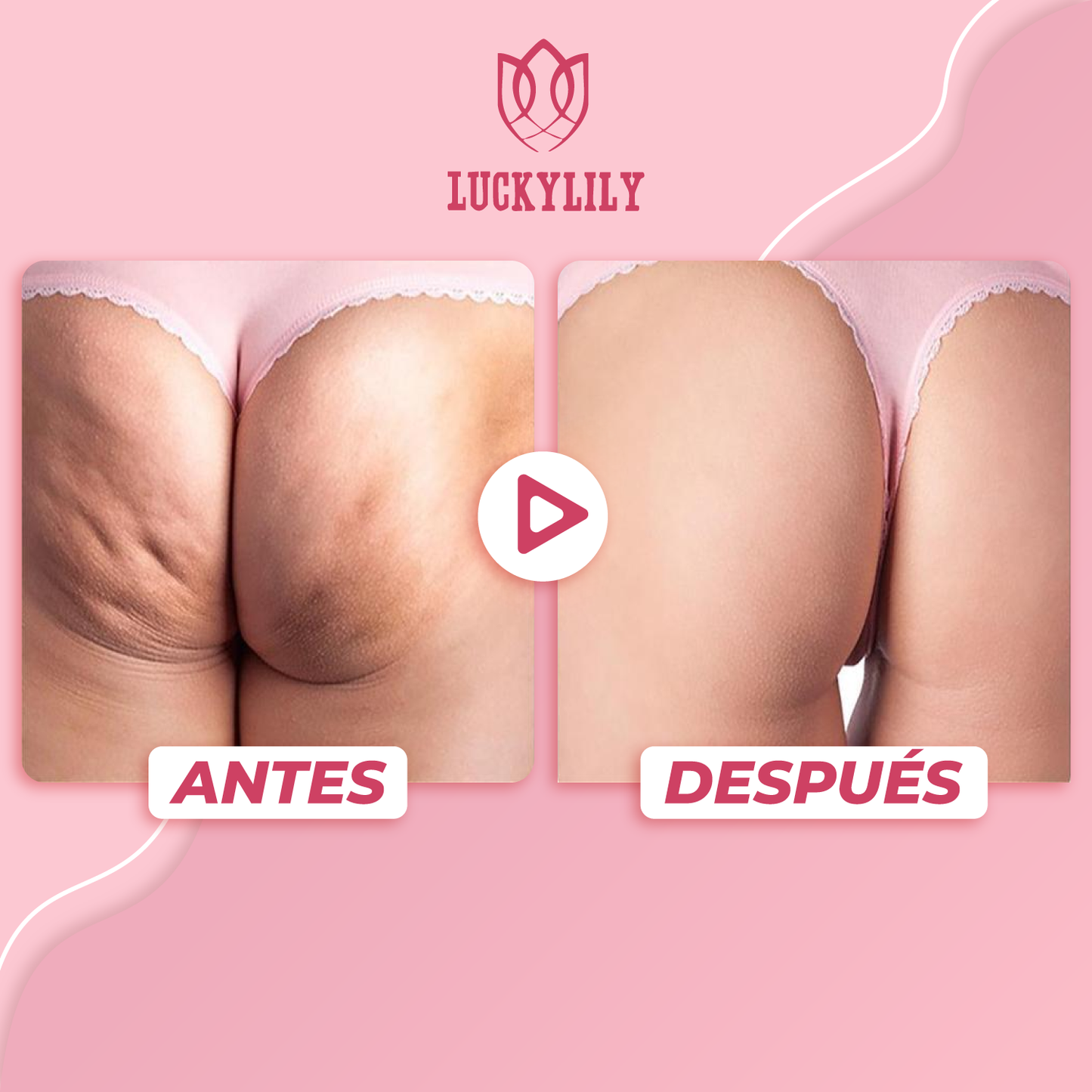 Crema reafirmante y tonificadora de gluteos - Luckylily™