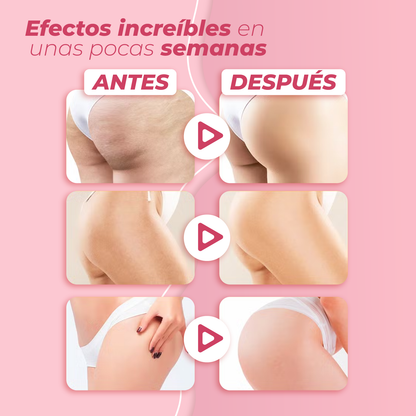 Crema reafirmante y tonificadora de gluteos - Luckylily™