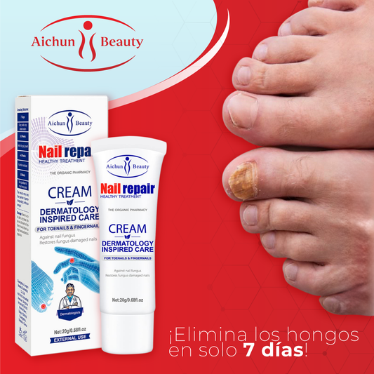 Crema para eliminar hongos en los pies - AichunBeauty™