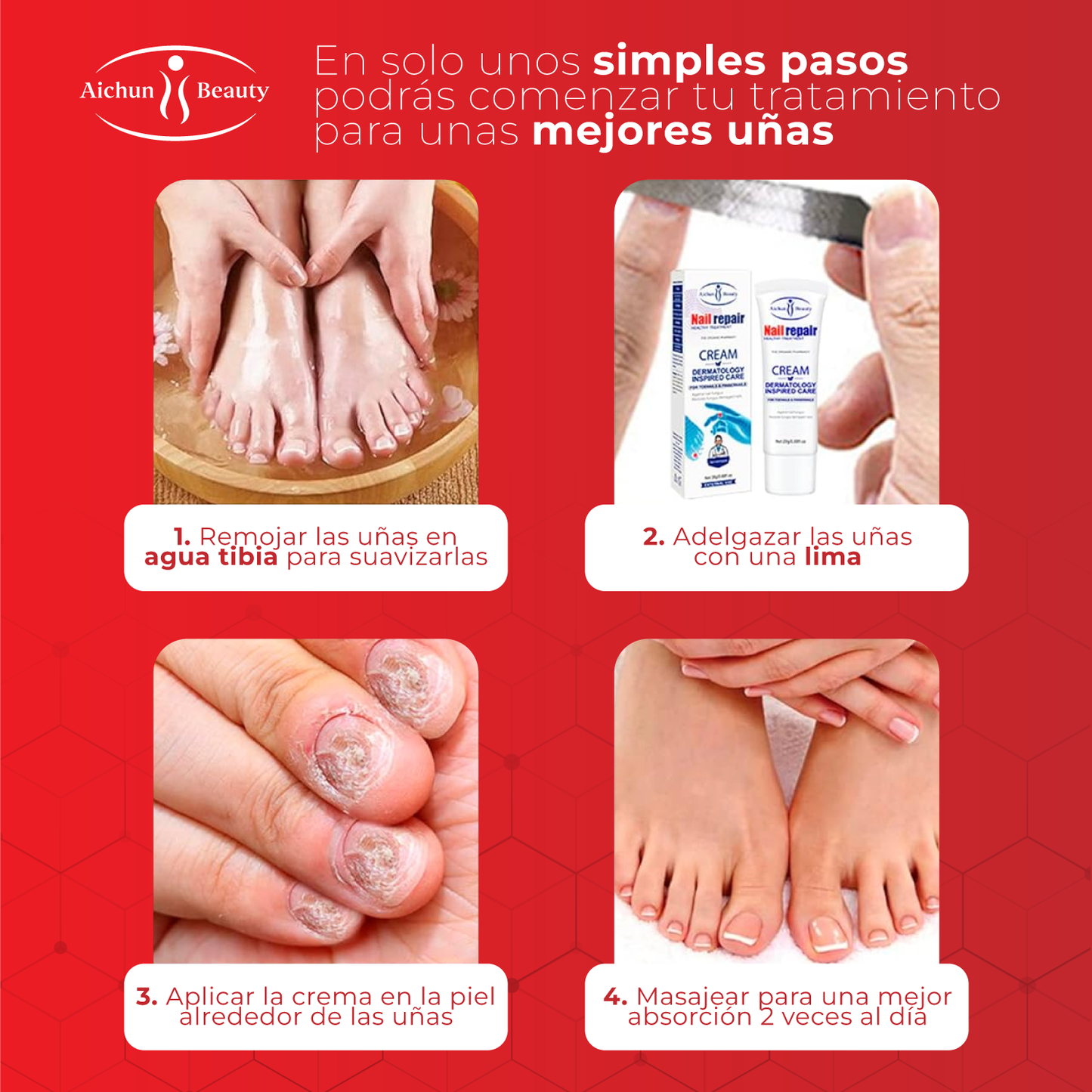 Crema para eliminar hongos en los pies - AichunBeauty™