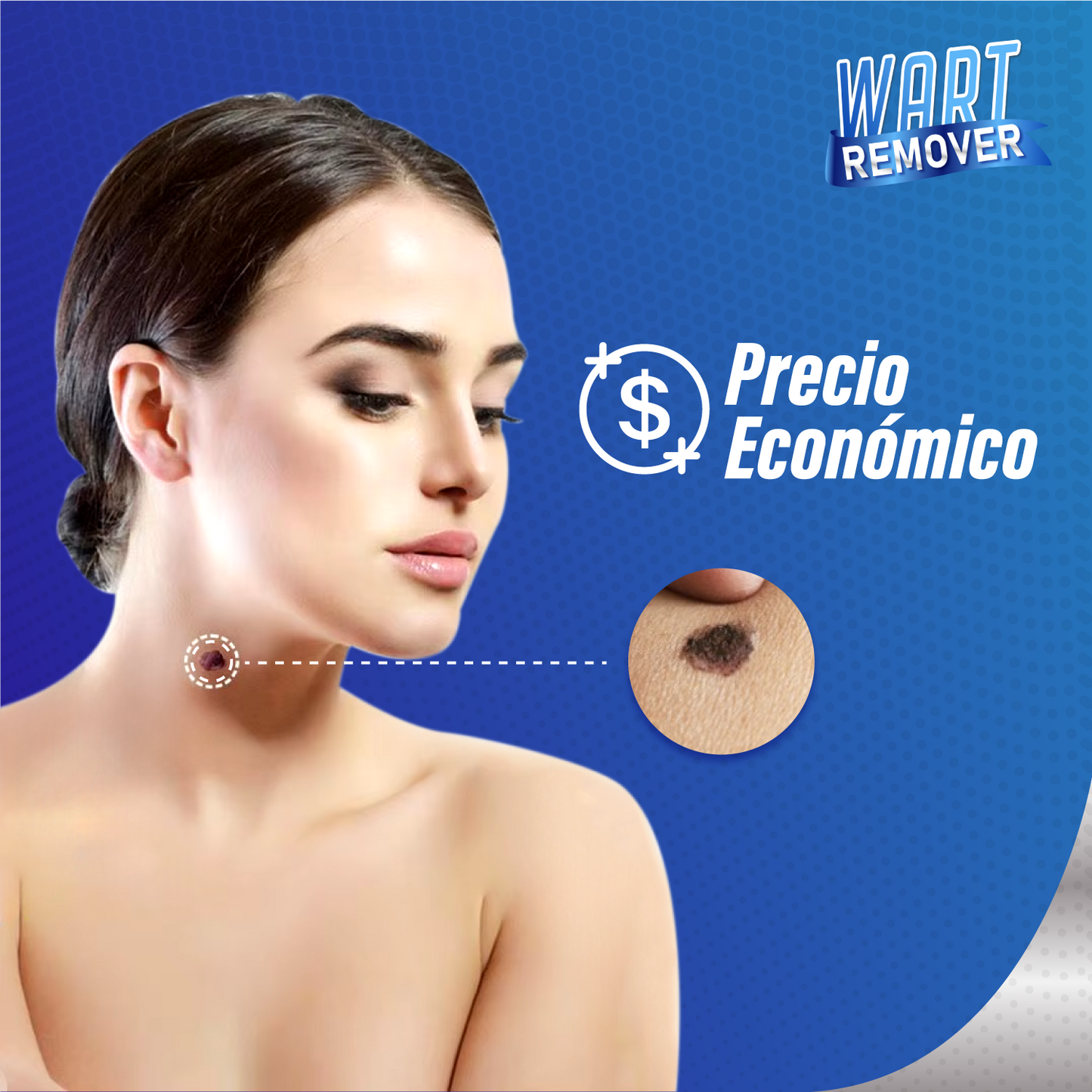 Crema removedora de verrugas - WartOff™