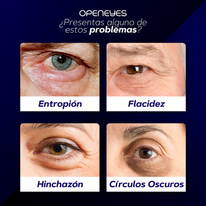 Crema para ojeras - OpenEyes™