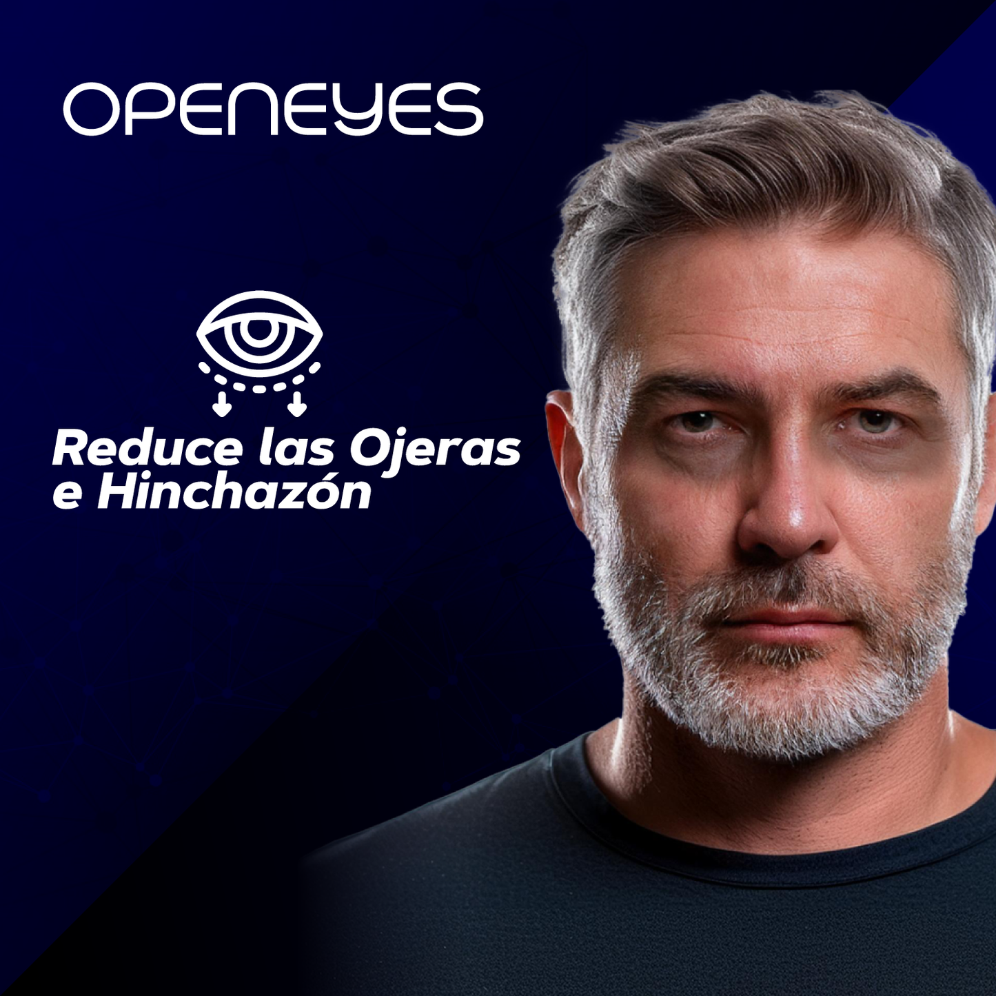 Crema para ojeras - OpenEyes™